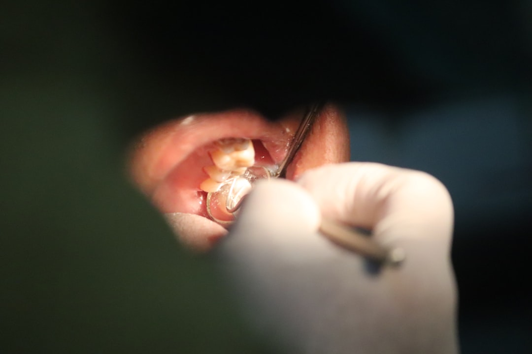 Dentist placing a tooth-colored composite filling using precision instruments