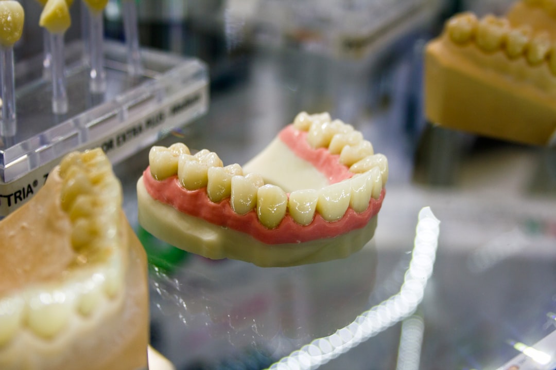 Close-up of a dental model showing tooth replacement options
