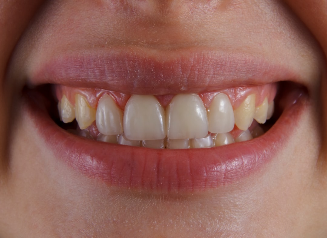 Receding Gums: Why It's Happening and How to Stop It